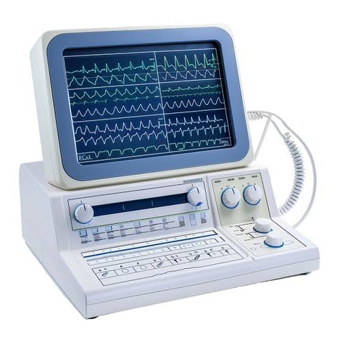 ECG