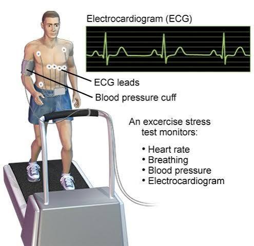 Stress Test TMT